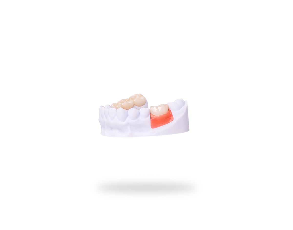 FREEPRINT® gingiva (500 g)